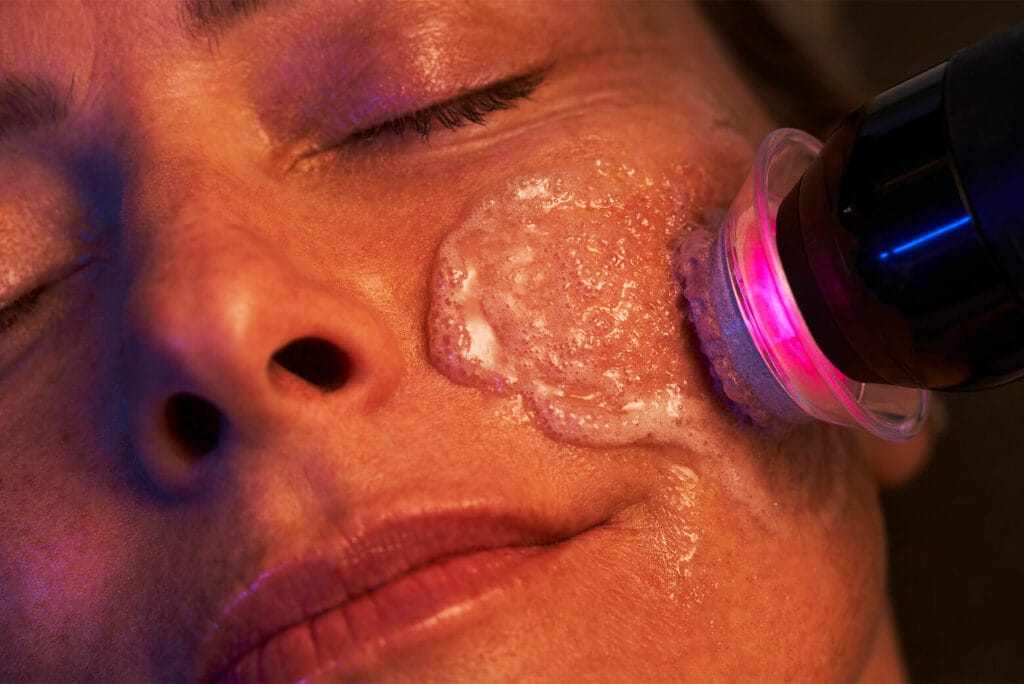 Glo2Facial OxyPods